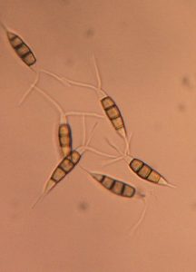  Conidia of Pestalotiopsis spp. 